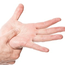 Carpal Tunnel Syndrome
